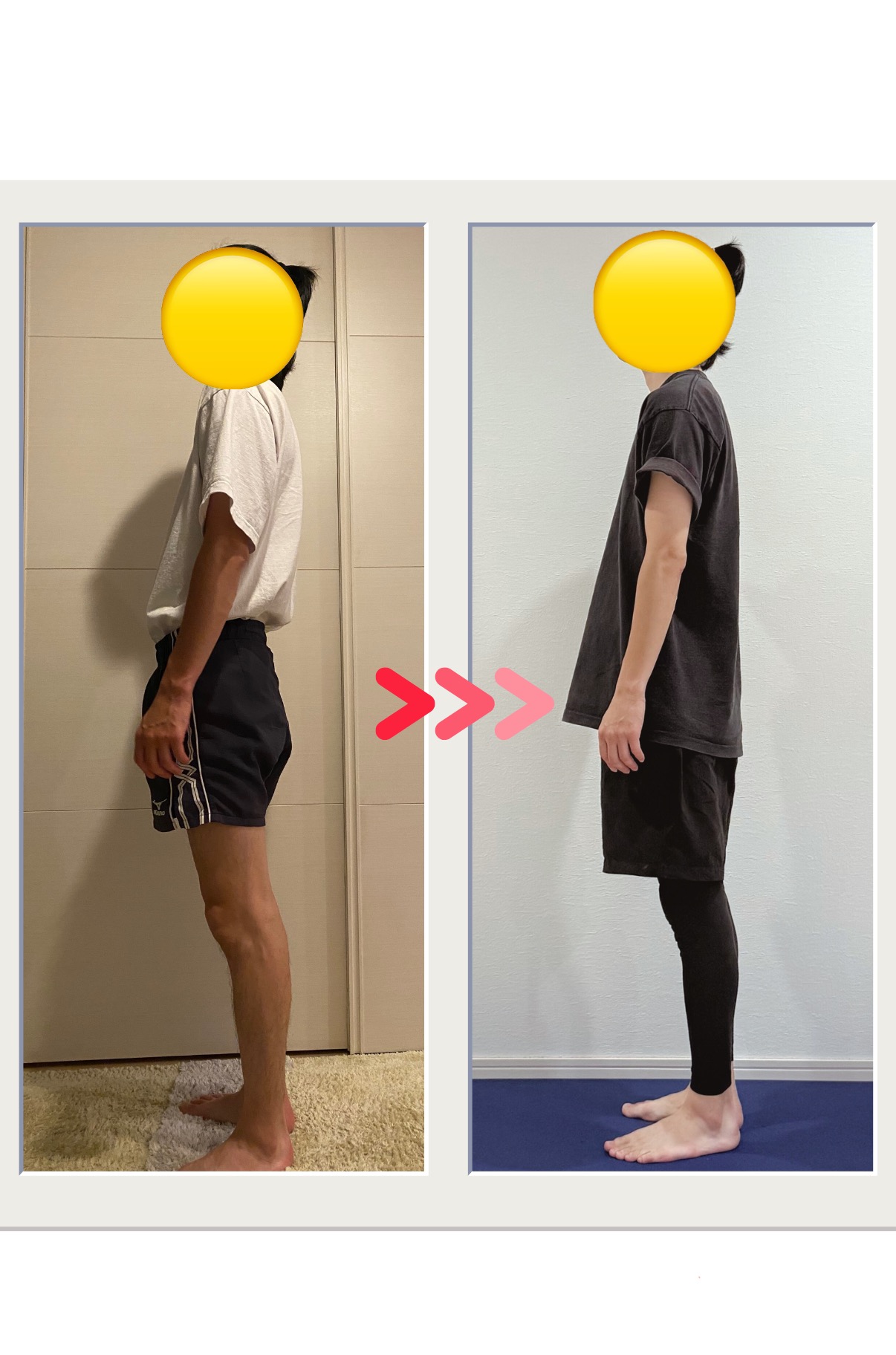 男性のお客様のレッスン前後における姿勢の変化
